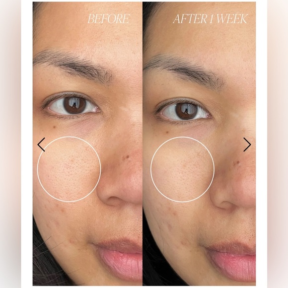 NIB Byroe Peach Kombucha Tea Purifying Clay Mask - Picture 10 of 12